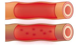 Consecintele metabolice ale disbiozei intestinale la cainii cu boala inflamatorie intestinala (BII). header image